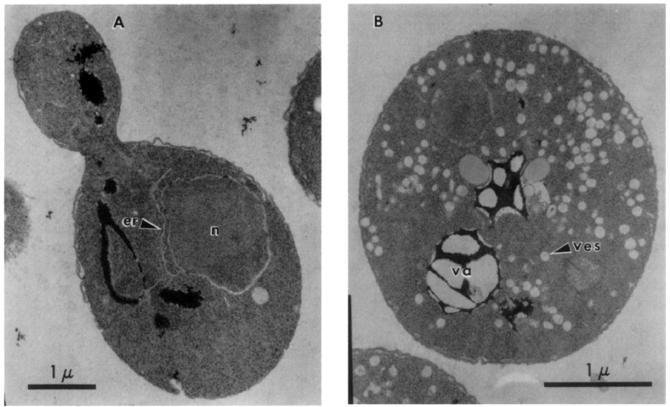 Figure 2.3. Thin section electron microscopy of yeast Saccharomyces cerevisiae. a) sec4-2 strain grown at permissive temperature resembles wild-type morphology.