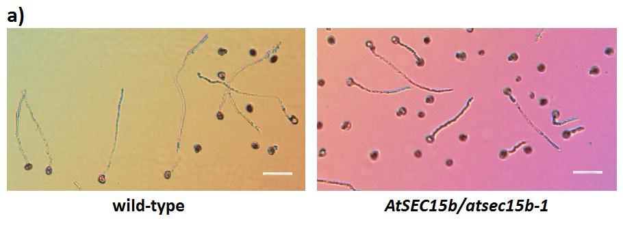 Figure 4.12. The atsec15b-1 mutation decreases the length of pollen tubes in vitro. a) An illustrative picture of germinated pollen from WT and heterozygous plants. Bars = 100 m.