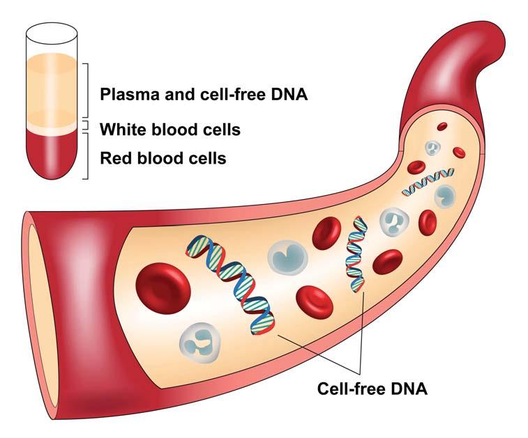 KLINICKÁ HODNOTA DIAGNOSTIKY Screening nejčastějších aberací autozomů na podkladě volných fetálních fragmentů DNA v mateřské plazmě reprezentuje v současné době nejefektivnější vyhledávací test