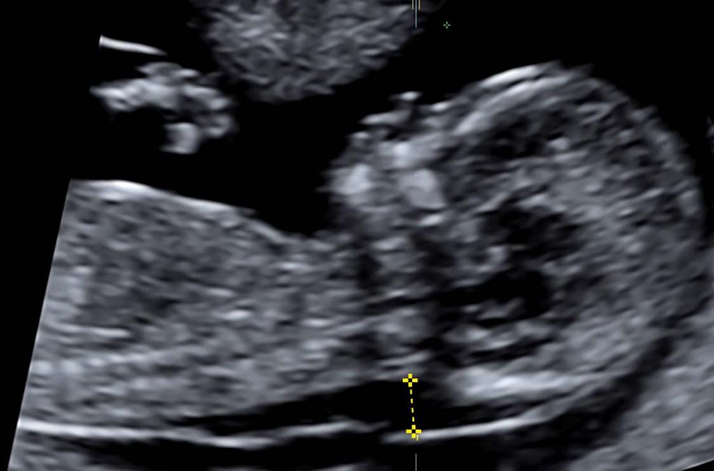 KLINICKÁ HODNOTA DIAGNOSTIKY v rámci normálního buněčného cyklu. Zároveň se na celkovém poolu cfdna spolupodílí i řada jiných orgánů, příkladem jsou adipocyty tukové tkáně.
