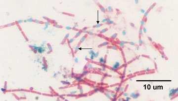 before the terminus of the chromosome is duplicated, an asymmetric membranaceous sporal sept irreversibly divides the cell into a major (sporangium) and a minor (forespore) compartment.