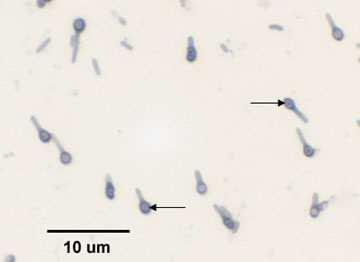 Such a polarity guarantees the deposition of peptidoglycan in the intermembrane space.