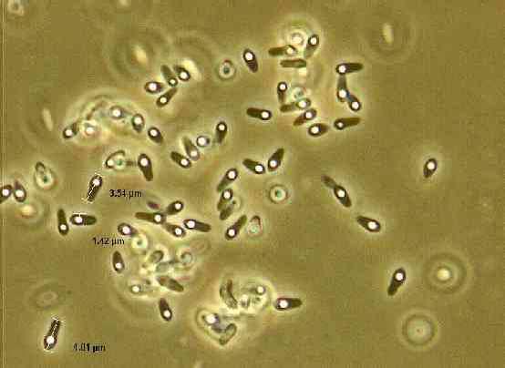 Bacillus