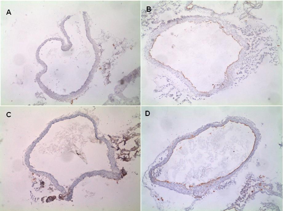 5.3 Imunohistochemická analýza - preparáty Obrázek 8: Reprezentativní preparáty imunohistochemické detekce molekuly endoglinu (A,C) a VCAM-1 (B,D) v ascendentní části aorty u apoe-deficientních myší,