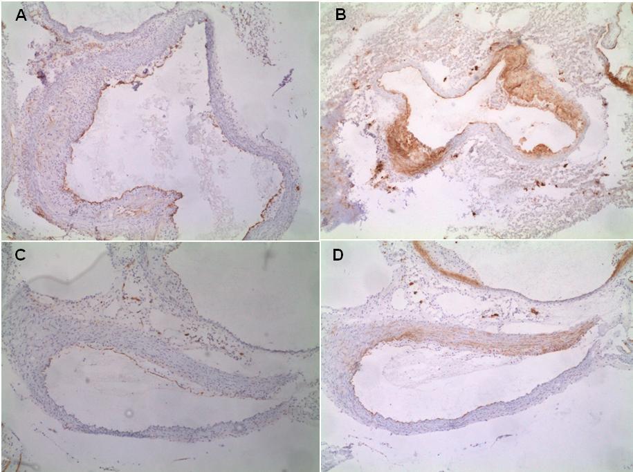 Obrázek 9: Reprezentativní preparáty imunohistochemické detekce molekuly endoglinu (A, C) a VCAM-1 (B, D) v ascendentní části aorty u apoe-deficientních myší, které byly krmeny Western type diet po