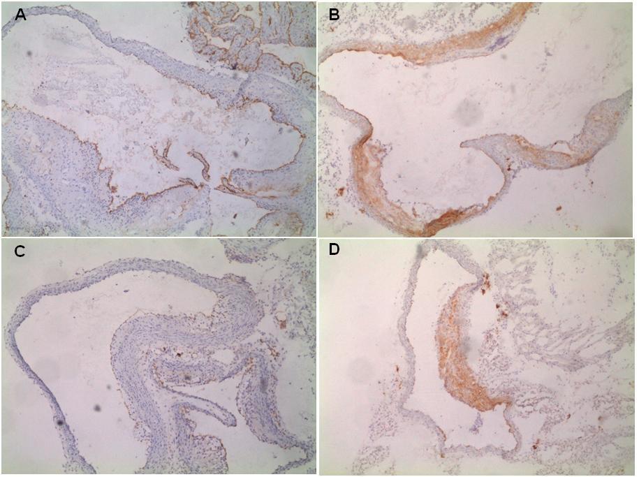 Obrázek 10: Reprezentativní preparáty imunohistochemické detekce molekuly endoglinu (A, C) a VCAM-1 (B, D) v ascendentní části aorty u apoe-deficientních myší, které byly krmeny Western type diet po