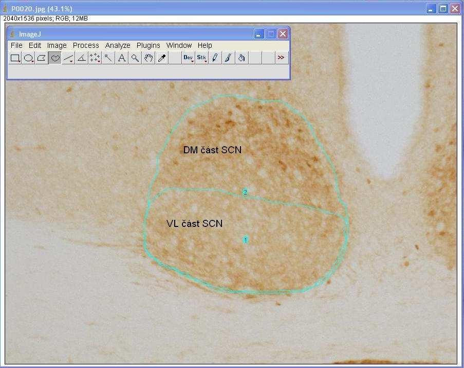 4.4.2. Počítání buněk v SCN Určení počtu buněk ve Vl a Dm části SCN se vyhodnocovalo manuálně pomocí Cell counter pluginu jako součásti softwaru ImageJ (NIH).