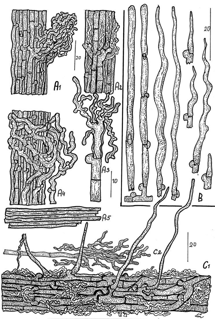 Obr. II. Anatomie hyfových svazků, rizoidů a cystid u vatičky šídlonosné Tomentella atroarenicolor.