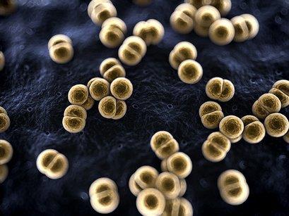 Invazivní meningokokové onemocnění IMO původce: Neisseria meningitidis - gramnegativní diplokok podle druhu
