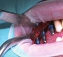 SPECIÁLNÍ PŘÍLOHA PRAKTICKÝ KURZ - LIVE OPERACE: SINUS LIFT, BONE SPLITTING A POUŽITÍ CBCT V PRAXI DATUM: Sobota 16.11.2019 od 9:00 hod.