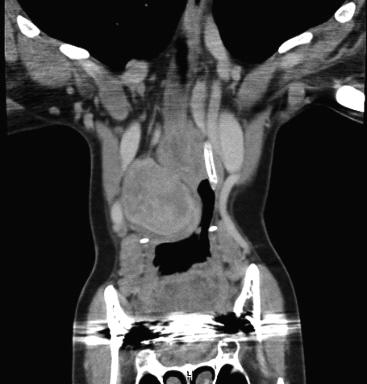Jako jeden z prvních popsal neurofibromatózu typu 1, hemochromatózu a některé funkce lymfatického systému. Byl otcem známého německého fyziologa Heinricha v. R. (1867 1942).