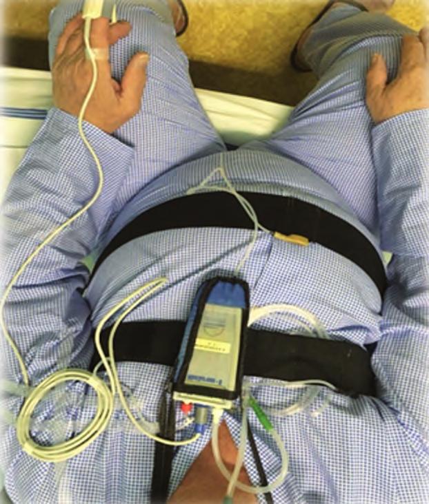 SPOLUPRÁCE DIABETIKA S OBSTRUKČNÍ SPÁNKOVOU APNOÍ PŘI LÉČBĚ PŘETLAKOVOU TERAPIÍ Efektivita léčby se hodnotí podle reziduálního AHI (zaznamenávaného přístrojem za období od poslední kontroly) a