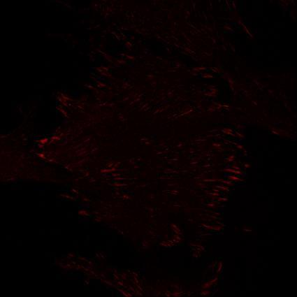 : Kolokalizace variant proteinu CAS s paxillinem ve fokálních adhezích. A) Reprezentativní obrázky buněk exprimující jednotlivé varianty proteinu CAS.