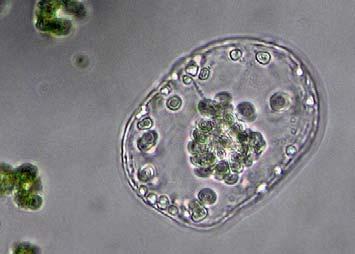 Embryokultury a