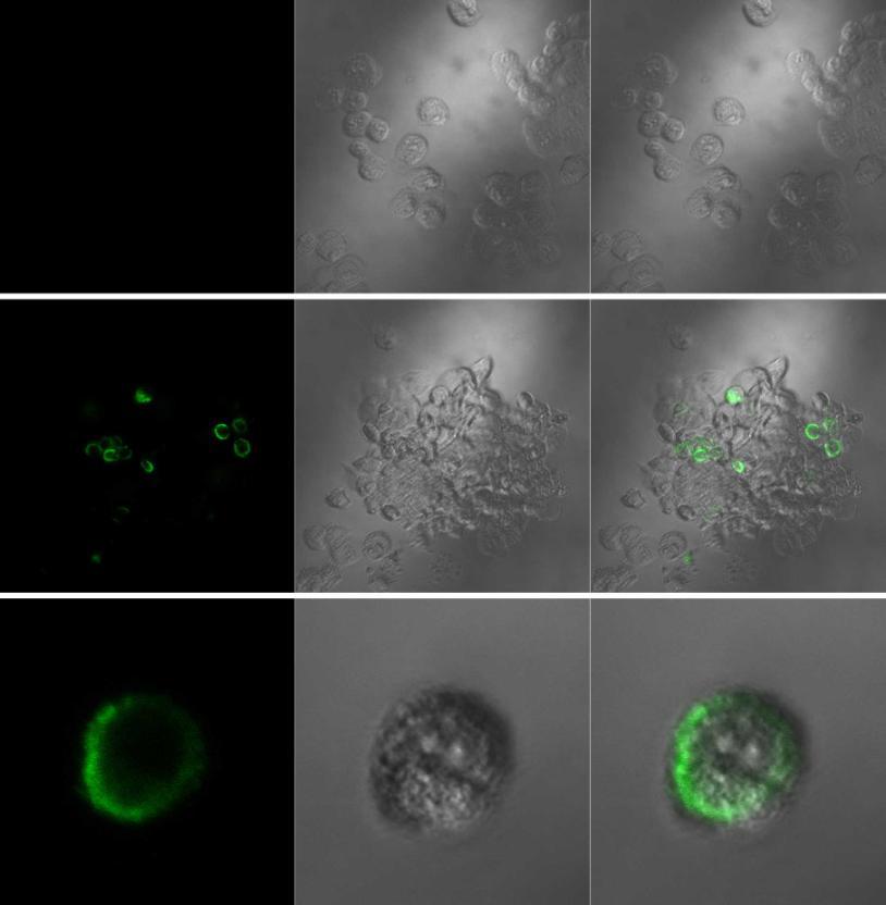 - 49 - Obr. 21: Imunofluorescence PIN1 u nepermeabilizovaných buněk HEK293T Exprese PIN1 byla sledována protilátkami a fluorescence detekována pomocí konfokálního fluorescenčního mikroskopu.