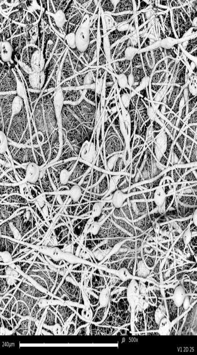 RESULTS Scanning electron images of electrospun material: PCL fibers (from chloroform/ethanol 9:1 solution) wet electrospun into distilled water