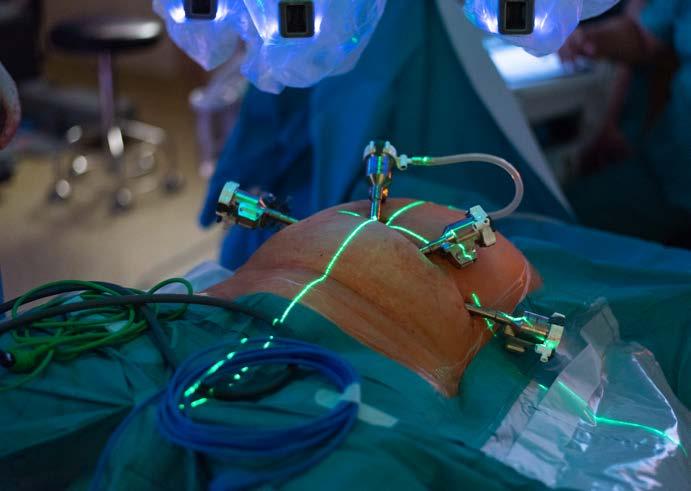 Specialisté operují s nejnovější verzí robotického systému Da Vinci Více než dva a půl tisíce operací provedli od roku 2009 specialisté v robotickém centru Fakultní