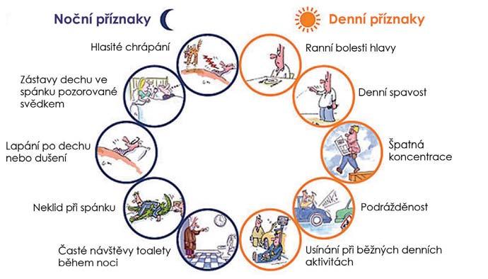 332 Obstrukční spánková apnoe v ambulantní péči Obr. 1 Klinické příznaky obstrukční spánkové apnoe * Upraveno dle CPAP guide (https://cpapguide.