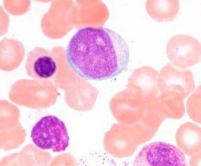 Granulopoéza myeloblast prekursorová buňka 15-20 µm, jádro s jemně rozptýleným chromatinem, více