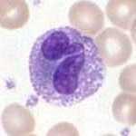 Eosinofily hlavním faktorem pro diferenciaci je IL-5 chemotaktickými faktory (z T-ly a mastocytů) jsou např.