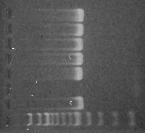Obrázek 10: Agarózová gelová elektroforéza produktů PCR specifických pro doménu Bacteria (466 bp). Amplifikováno bylo 10 ng DNA izolované z kmenů Lactobacillus.