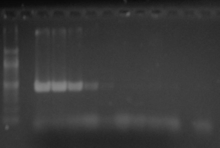 Obrázek 11: Agarózová gelová elektroforéza produktů PCR pro doménu Bacteria (466 bp). Amplifikován byl 1 µl DNA Lactobacillus casei CCM 4798 obsahující 10 ng 1 fg DNA.