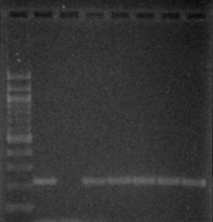 6.4.2 PCR specifická pro rod Lactobacillus Důkaz přítomnosti DNA bakterií rodu Lactobacillus byl proveden metodou PCR s primery specifickými pro rod Lactobacillus. Postup práce je uveden v kapitole 5.