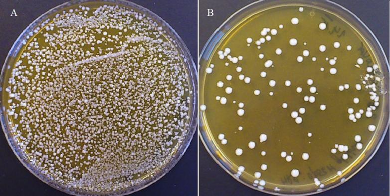 TEM analýza potvrdila produkci nanočástic stříbra buňkami kmene L. casei CCM 4791. Byly pozorovány individuální nanočástice stříbra a také agregáty nanočástic.