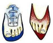 3. 6 Hygienické podmínky obouvání Dle Suchého (1979) plní obuv tři zásadní úkoly: zajišťuje tepelnou izolaci, podporuje nožní klenbu a ochraňuje nohu před zraněním.