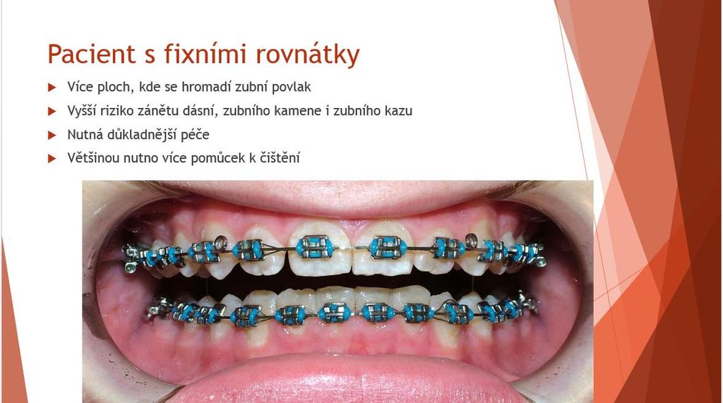 Snímek 16