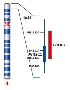 Použité sondy FIRMA KREATECH MD Wolf-Hirschhorn WHSC1 (4p16) / SE4 Obrázek č. 13: Ideogram chromozómu 4 a vizualizace oblasti, na kterou se sonda váže (Kreatech Diagnostics, 2014 www.kreatech.com).