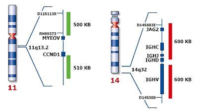 ON MYEOV/IGH t(11;14) Fusion Obrázek č. 17: Ideogram chromozómů 11, 14 a vizualizace oblastí, na které se váže sonda ON MYEOV/IGH (Kreatech Diagnostics, 2014 - www.kreatech.com).