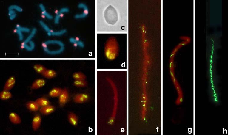 Chromosoma Fig. 1 Morphology of P. conica spermatid nuclei.