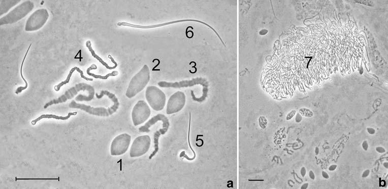 Bars=400 μm some bivalents look like a metacentric chromosome, and the chiasma might be confused with a centromere, although this is not the case.