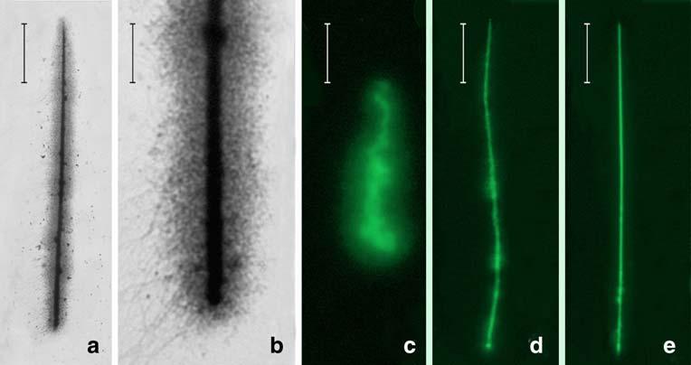 Chromosoma Fig. 3 DNA loops release in the DTT-treated elongating spermatids.