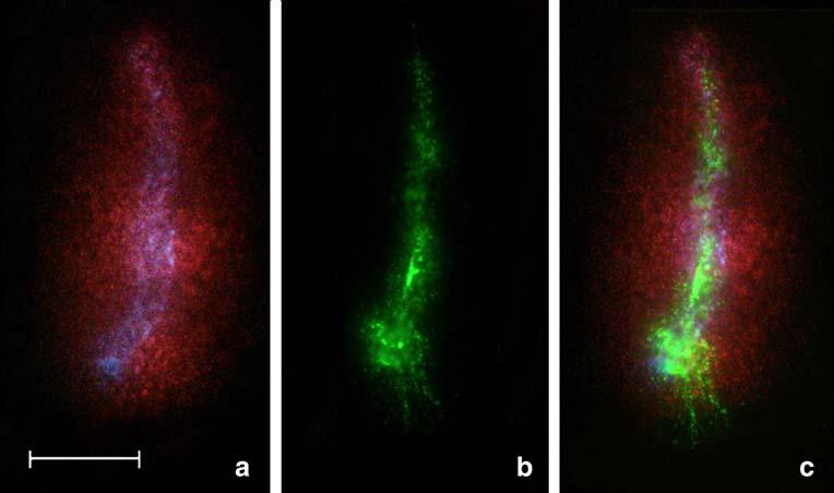 c Early spermatid nuclei showing the chromatin halo formed by DNA loops after SybGreen II staining. d, e No dispersed chromatin halo is observed in the absence of DTT, i.e., when the disulfide bridges remain undisturbed.