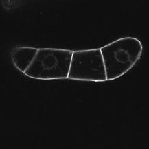 (C) IAA (5 μm).