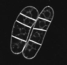 effect of auxins on