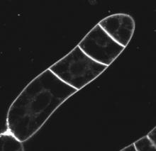 microscopy of FM