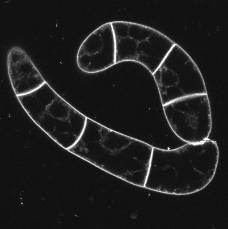 tobacco BY-2 cells