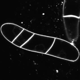 Inhibitors of cytoskeletal