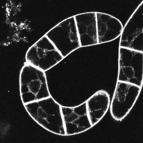 min pre-treatment with cytoskeletal