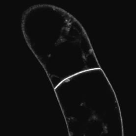 Untreated Wm + BFA IAA + BFA A E I BFA Fil + BFA 2,4-D + BFA B F