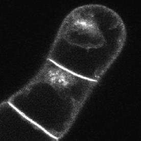 inhibition of anterograde trafficking of PIN1-GFP.