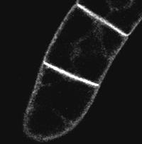 (A) Control cells with equal amount of solvent.