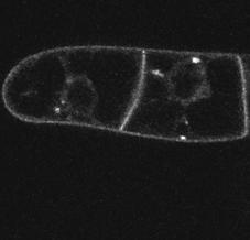 PIN1-GFP intracellular aggregation.