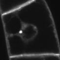FM 4-64 endocytosis 5 10 15 20 FM 4-64 endocytosis Remarks PIN1 localization after BFA Remarks on the