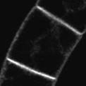 tyrosine, blocking tyrosine kinases, binding in Tyr pocket of proteins disable the AP-2 protein