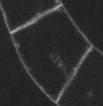 2008 Matsuoka et al. 1995 Emans et al.