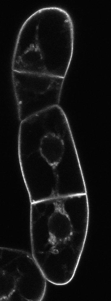 (a) PIN1-GFP